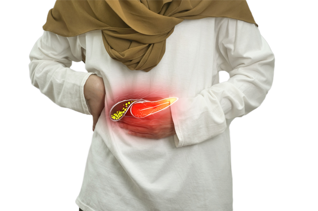 Gall Stone Disease
